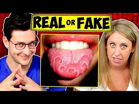 Doctor Challenges Comedian: Real Or Fake Disease?