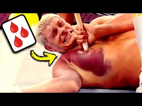 Real Doctor Reacts To Painful WWE Injuries